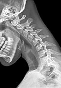 Image result for Chiropractic X-rays