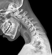 Image result for Chiropractor Neck