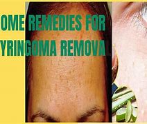 Image result for Syringoma Removal Cream