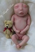 Image result for Anencephaly