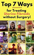 Image result for fibroids herbal remedy