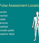 Image result for Carotid Pulse