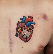 Image result for Open Heart Surgery Chest