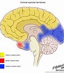 Image result for Brain Flow Chart