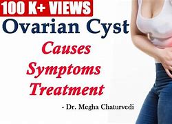 Image result for Pain From Ovarian Cyst