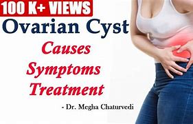 Image result for Ovarian Cyst Discharge