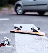 Image result for Skateboard Injuries