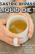 Image result for Gastric Sleeve Liquid Diet