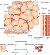 Image result for Adipose Tissue Inflammation