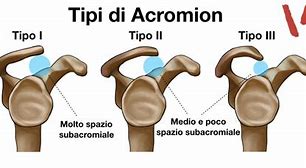 Image result for acromuon
