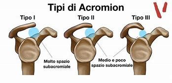 Image result for acromipn