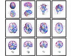 Image result for Anatomical Brain Art