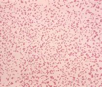 Image result for Diplococci Gram Stain