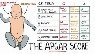 Image result for acgar�