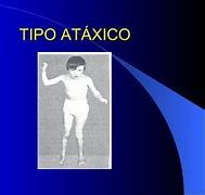 Image result for atectivo