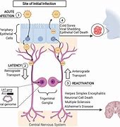 Image result for Herpes Simplex