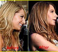 Image result for Vanessa Hudgens Before and After