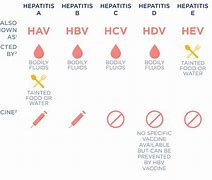 Image result for Acute vs Chronic Hepatitis