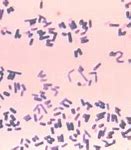 Image result for Gram-positive Bacilli Chart