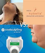 Image result for Kybella vs CoolSculpting Chin