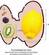 Image result for Tumor Pictures and Sizes
