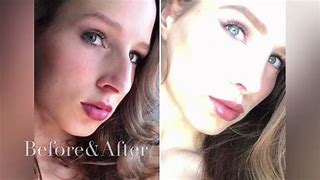 Image result for Pregnancy Nose Before and After