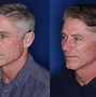 Image result for Aging Male Face