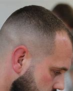 Image result for Bald Crown Haircut