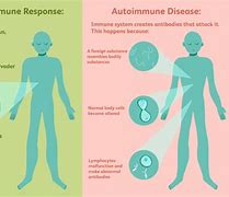 Image result for Autoimmune Skin Disease