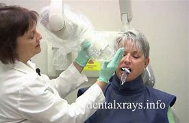 Image result for How to Do Dental X-rays