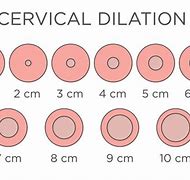 Image result for Cervical Dilation in Labor
