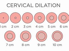 Image result for How Big Is 2 Cm Dilated