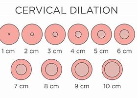 Image result for What Does 10 Cm Dilation Look Like