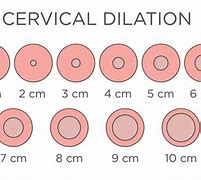 Image result for How Big Is 10 Cm Dilated