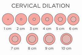 Image result for Cervix Dilation Diagram