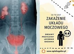 Image result for co_oznacza_zakażenie_układu_moczowego