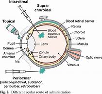 Image result for Intraocular Space