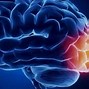 Image result for Cerebral Cortex Functional Areas