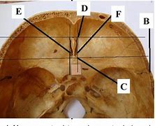 Image result for Foramen Cecum Frontal Bone