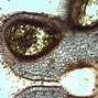 Image result for Cibule Pod Mikroskopem