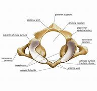 Image result for Atlas Vertebrae Anatomy