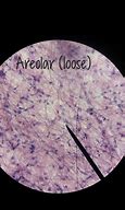 Image result for areolar