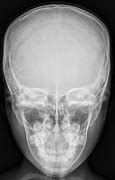 Image result for Head X-ray
