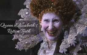 Image result for Queen Elizabeth Teeth
