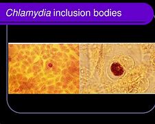 Image result for Chlamydia Inclusion Bodies