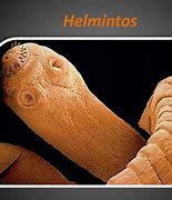 Image result for helminto