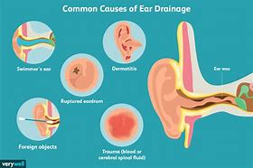 Image result for Warp Your Ear