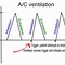 Image result for AC Mode Ventilator