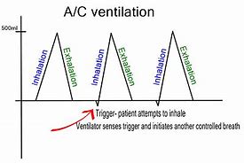 Image result for AC Mode Ventilator