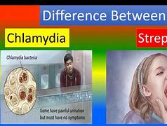 Image result for Chlamydia of the Throat